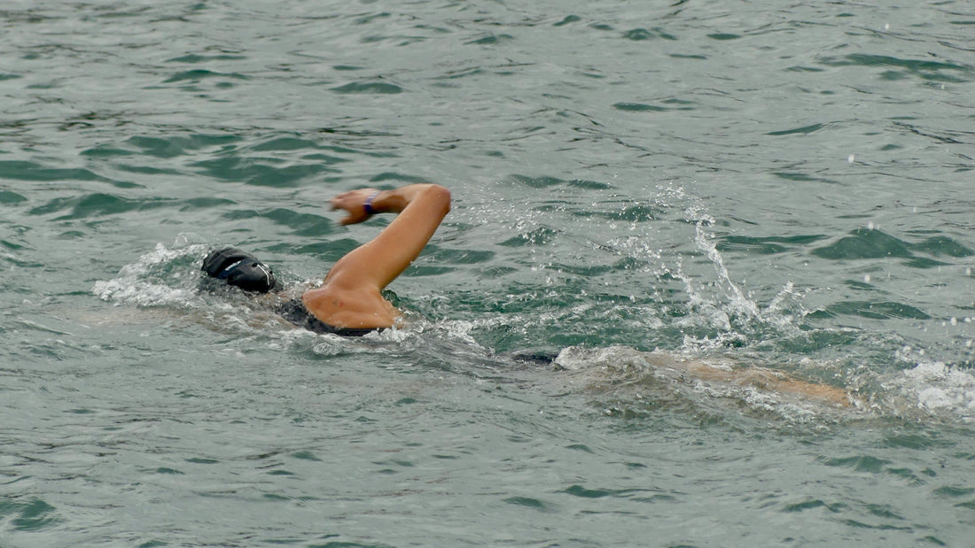 Why Omega 3 Is A Powerful Ally After Surgery