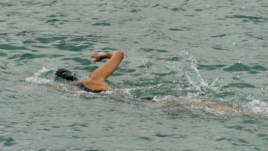 Why Omega 3 Is A Powerful Ally After Surgery